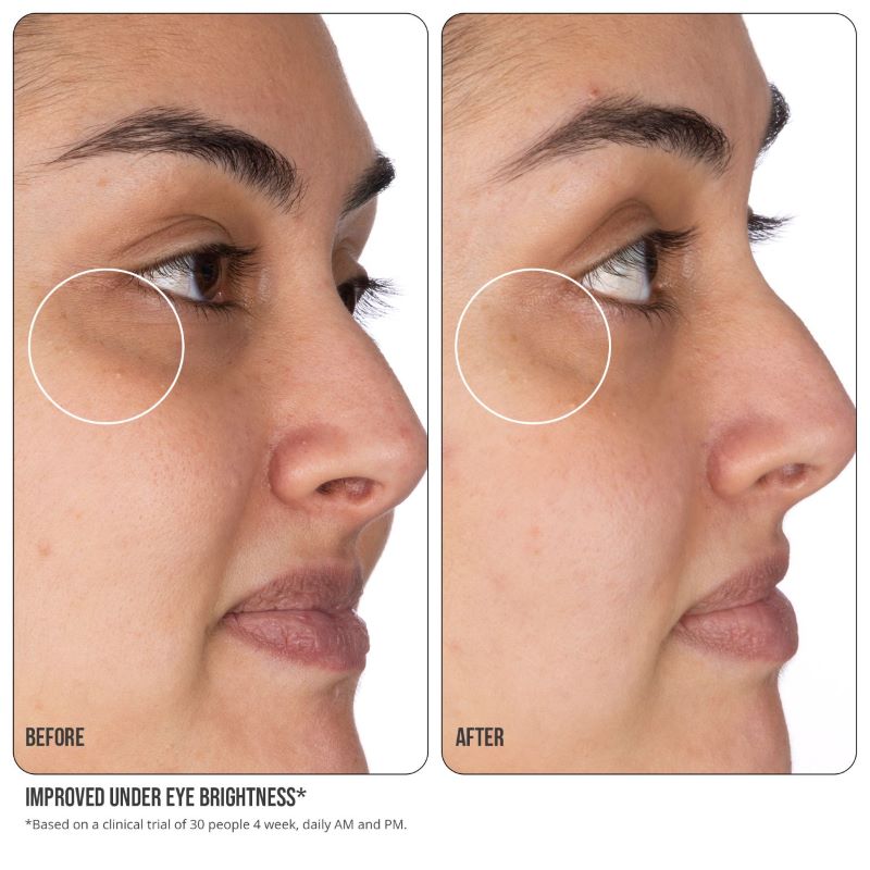 Các nghiên cứu về hiệu quả của Vitamin C đối với vùng da mắt